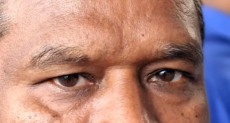 চোখে ময়লা ঢুকলে করণীয়, যা করবেন না